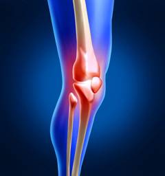 Изображение - Госпиталь вишневского эндопротезирование коленного сустава kneel1