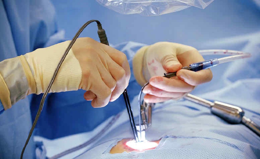 малоинвазивная лазерная хирургия