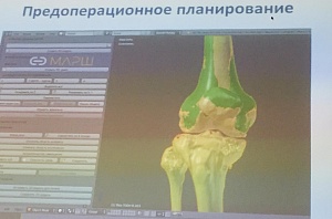 Травматолог-ортопед Василий Шишкин:  «Мы видим большой задел в области компьютероассистированной хирургии»